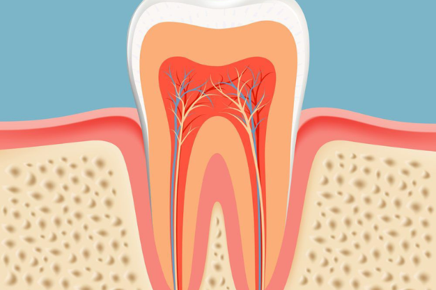 Kids RCT (Pulpectomy)