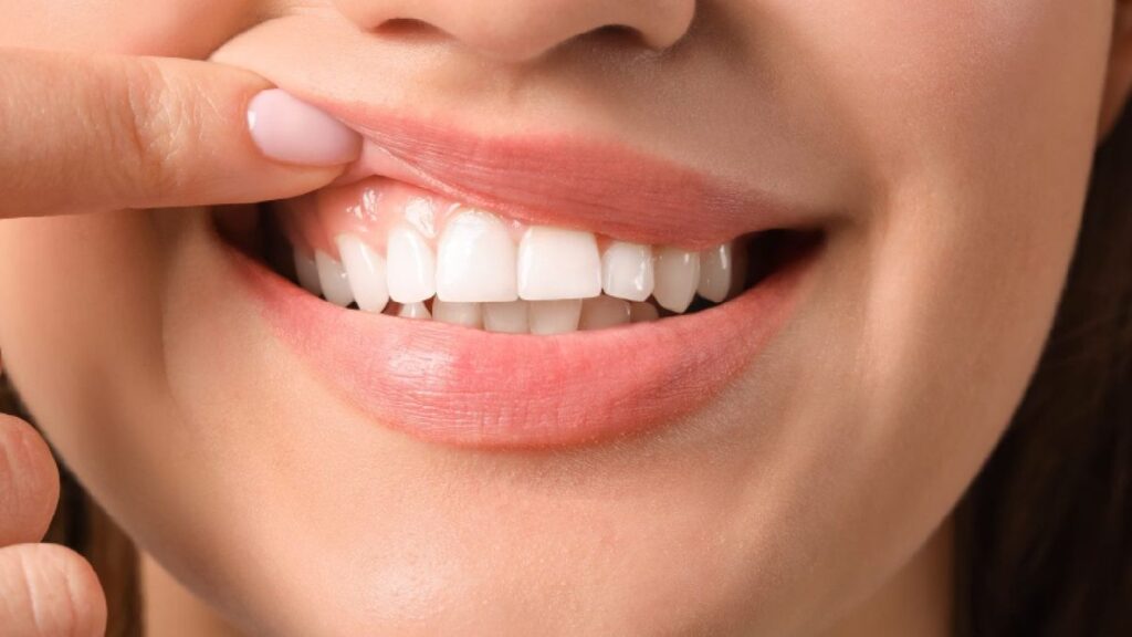 Healthy pink gums supporting strong white teeth for a confident smile