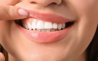 Healthy pink gums supporting strong white teeth for a confident smile
